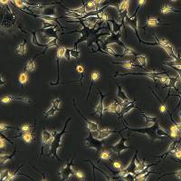 浙江（杭州）美森 小鼠骨样细胞 MLO-Y4