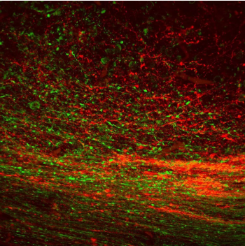 Immusmol-5-羟色胺（血清素）抗体现货促销，助力科研突破瓶颈