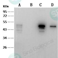 SARS-CoV/SARS-CoV-2 Nucleoprotein / NP Antibody，鼠单克隆抗体
