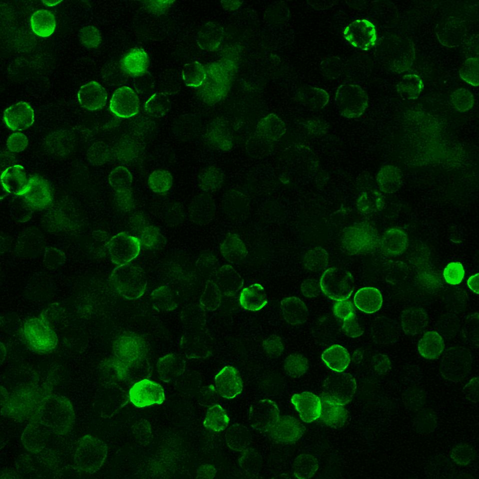 SARS-CoV / SARS-CoV-2 Nucleocapsid 兔单克隆抗体