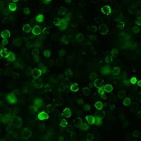 SARS-CoV / SARS-CoV-2 Nucleocapsid 兔单克隆抗体