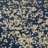 浙江(杭州)美森 昆虫细胞 SF9