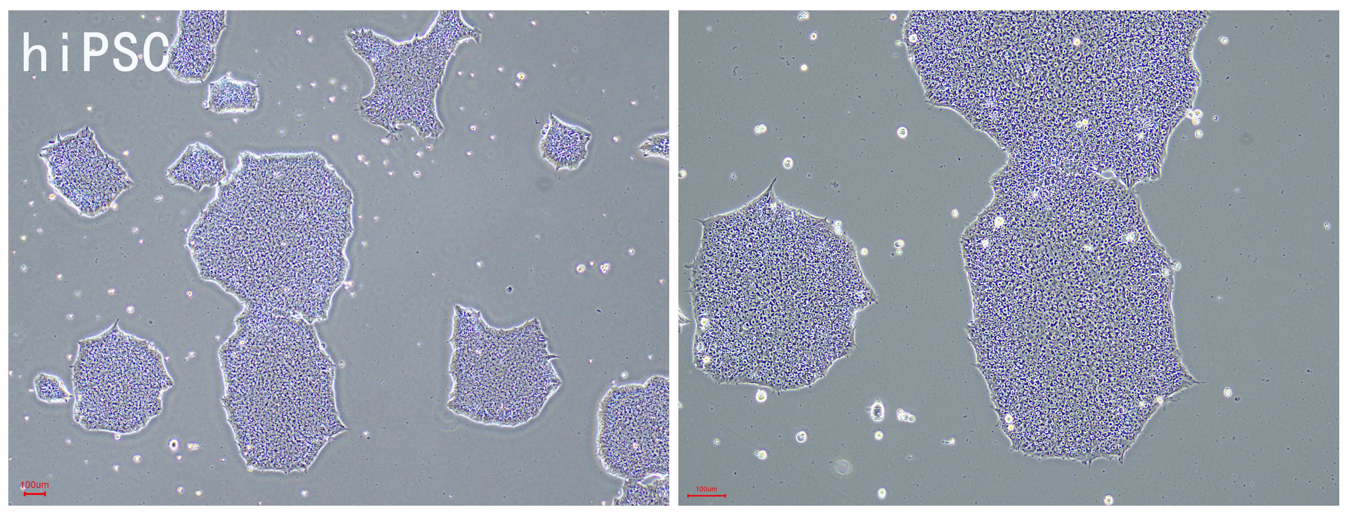 FyPluri(TM) hESCs/hiPSCs人多能干细胞全合成培养基