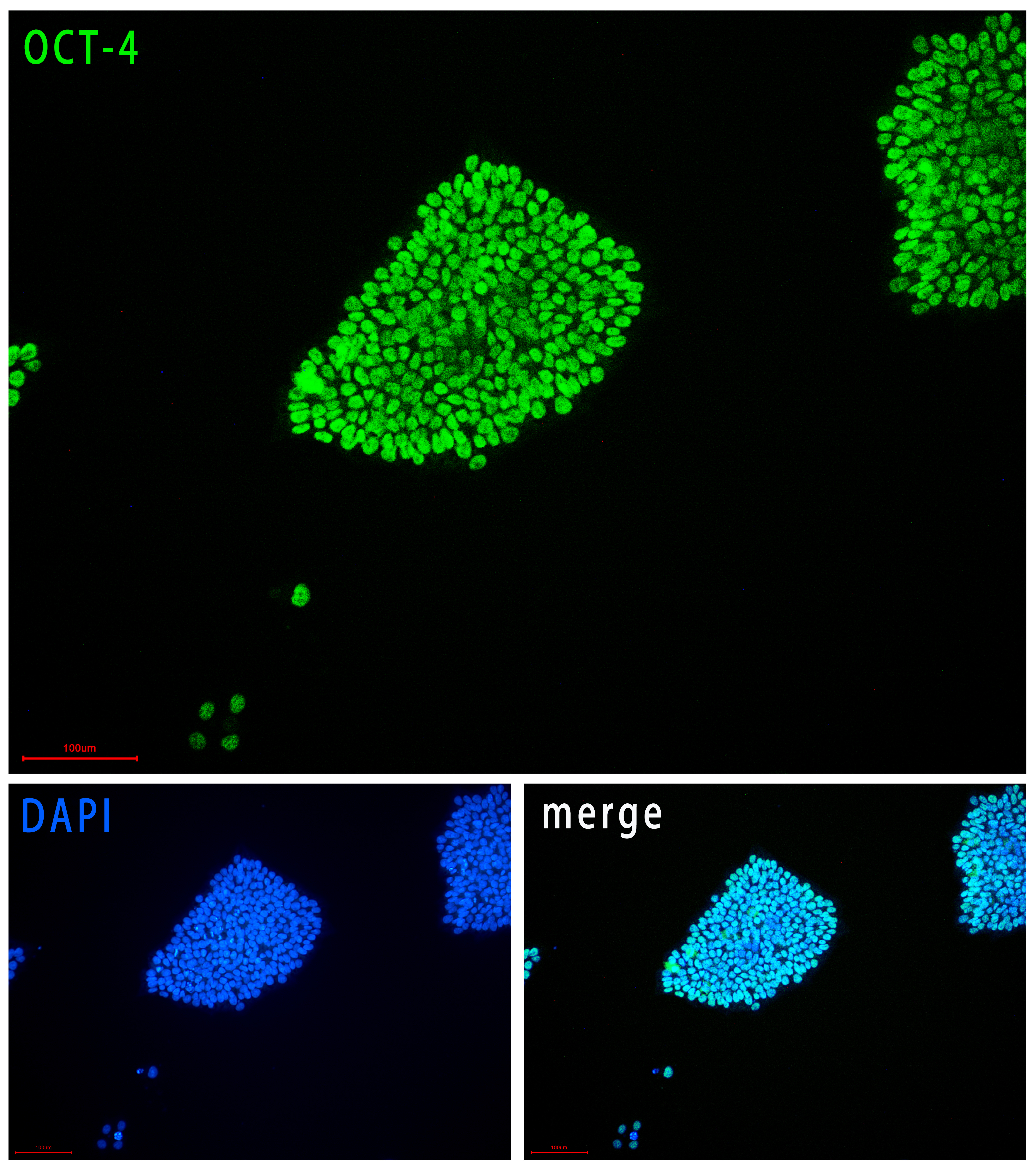 FyPluri(TM) hESCs/hiPSCs人多能干细胞全合成培养基