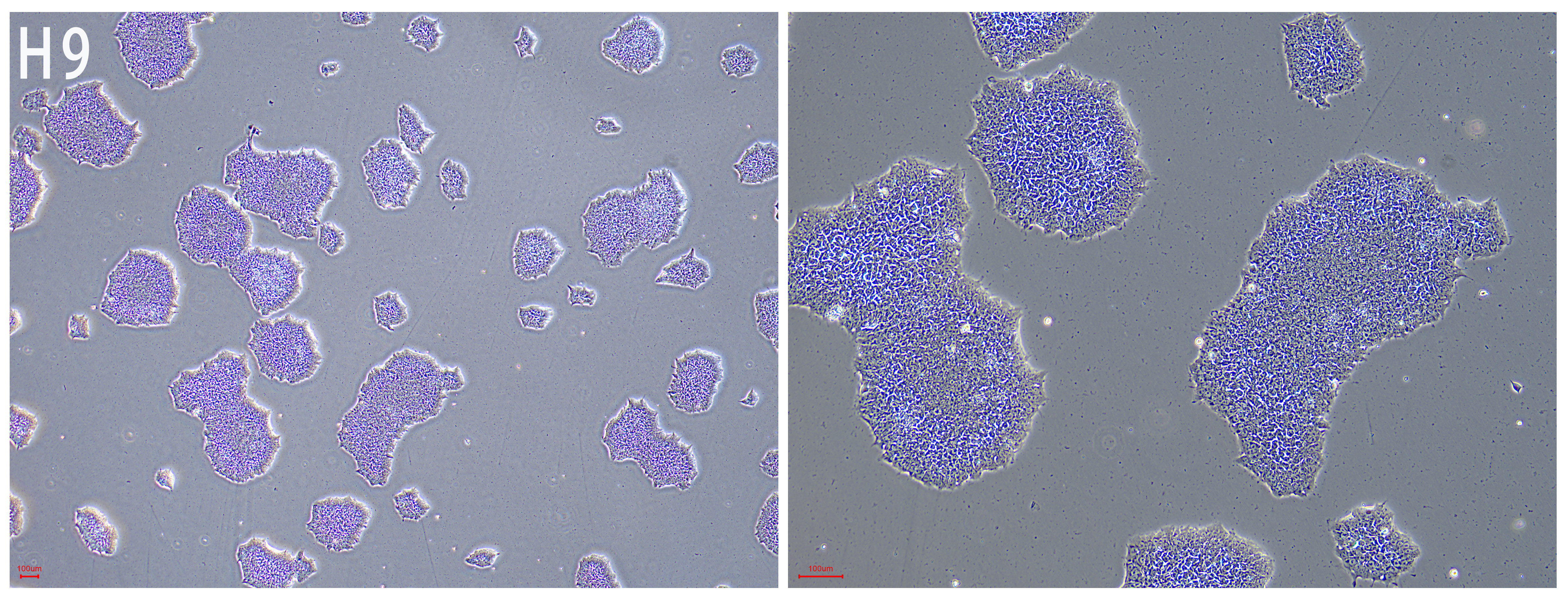 FyPluri(TM) hESCs/hiPSCs人多能干细胞全合成培养基
