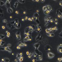 浙江（杭州）美森 人肝癌细胞JHH-7（Luc2）现货