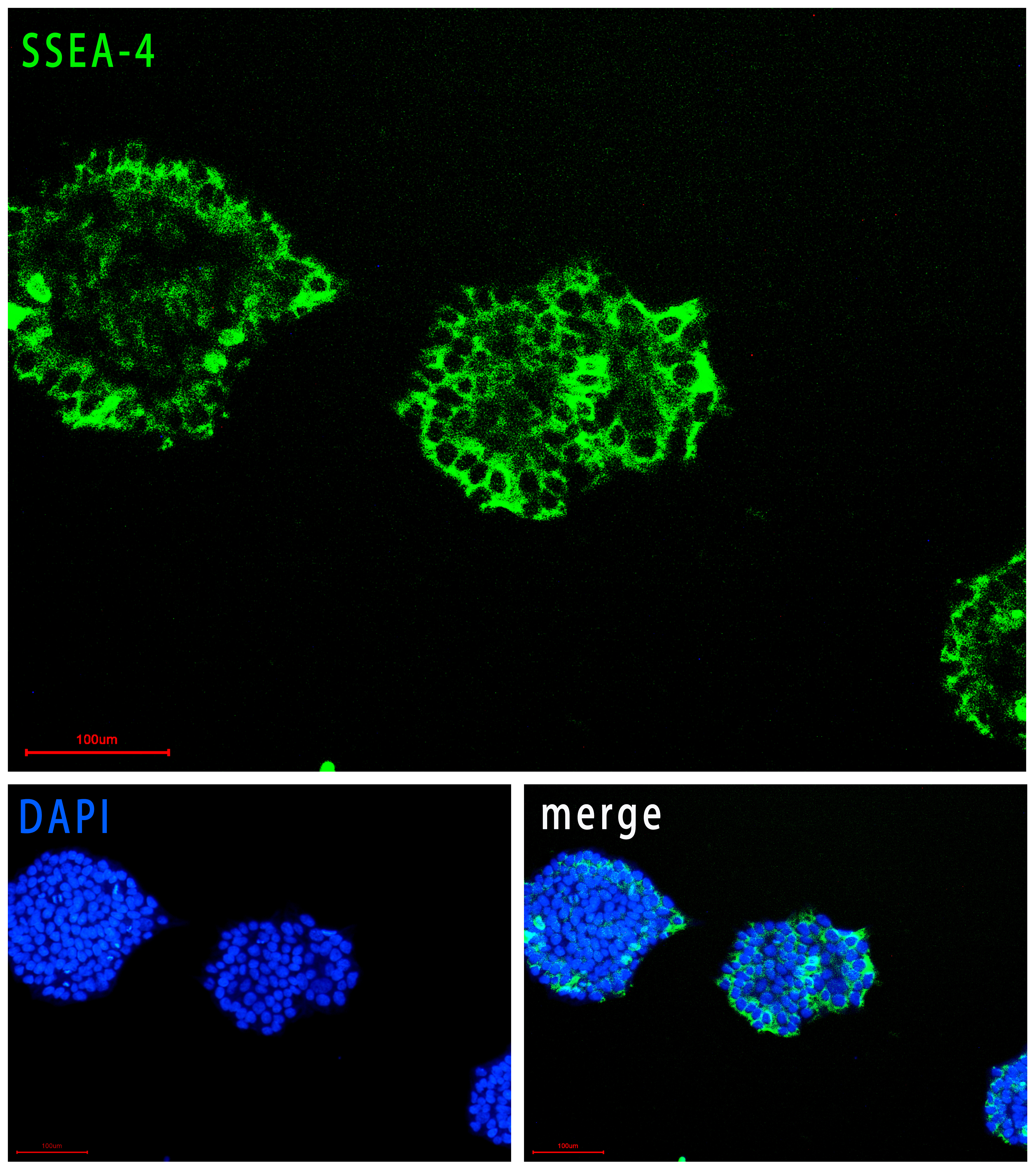 FyPluri(TM) hESCs/hiPSCs人多能干细胞全合成培养基