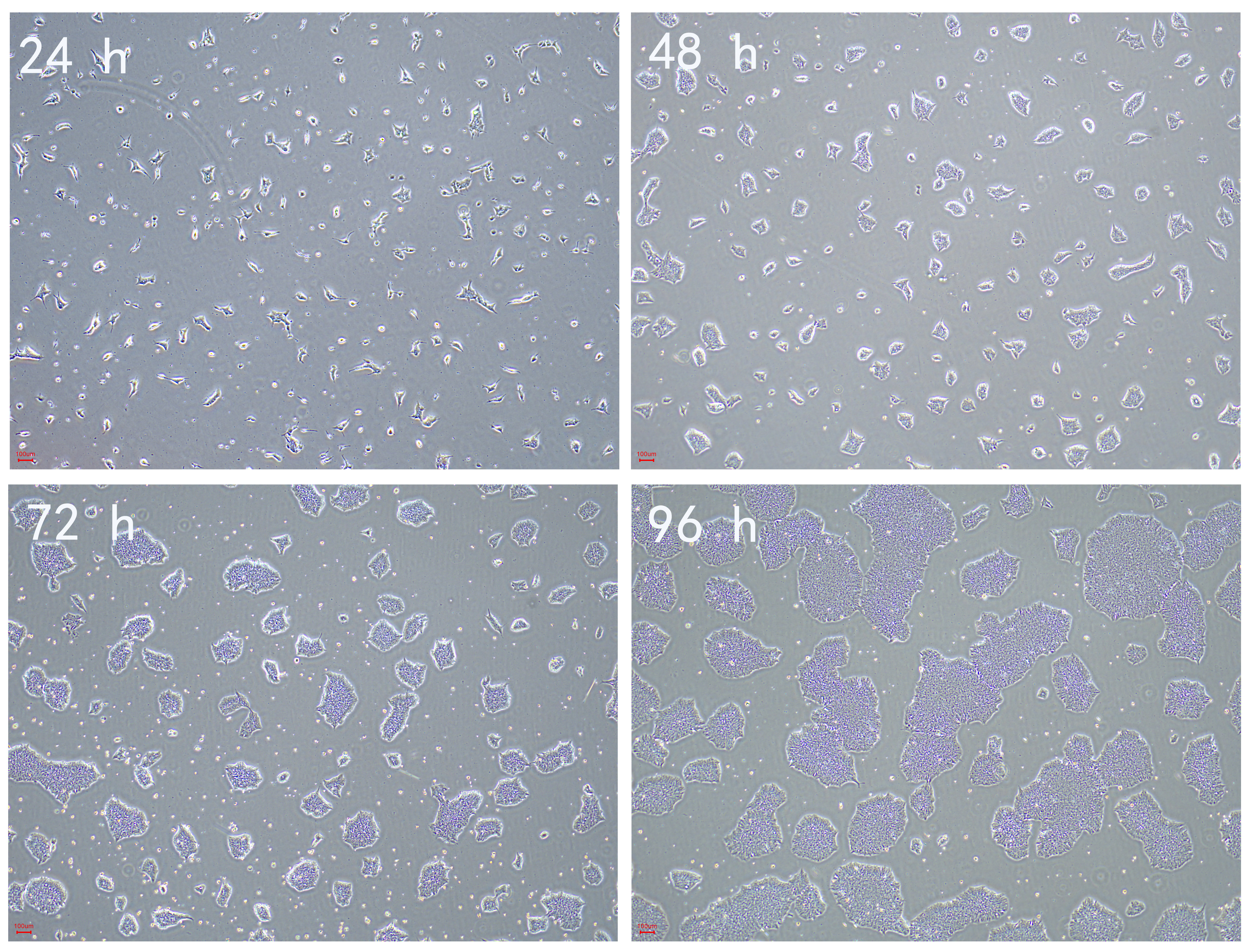一手数据：hESCs人胚胎干细胞生长状态和增殖速度（高清图片）