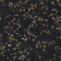 浙江（杭州）美森 肝癌细胞SNU-878（Luc2）现货