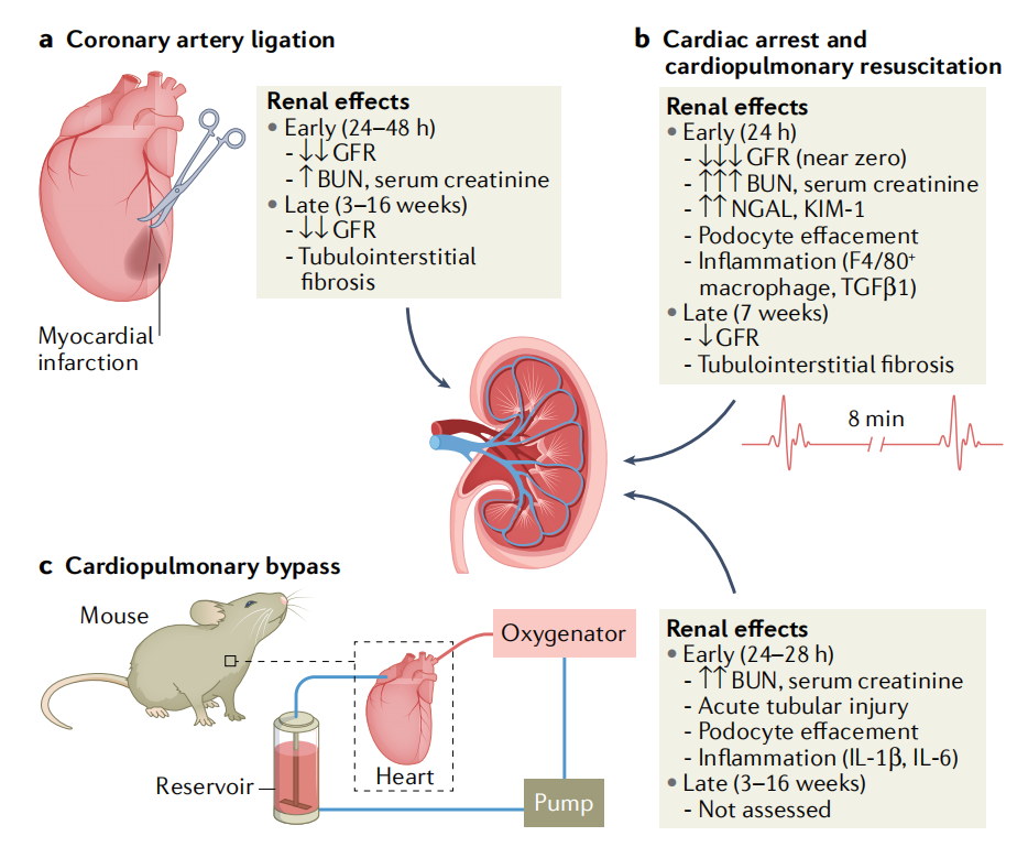 「急性肾损伤」动物模型的构建