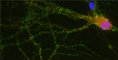 NanoTag-FluoTag-X2抗突触素1（7D5）促销季，助力科研加速前行