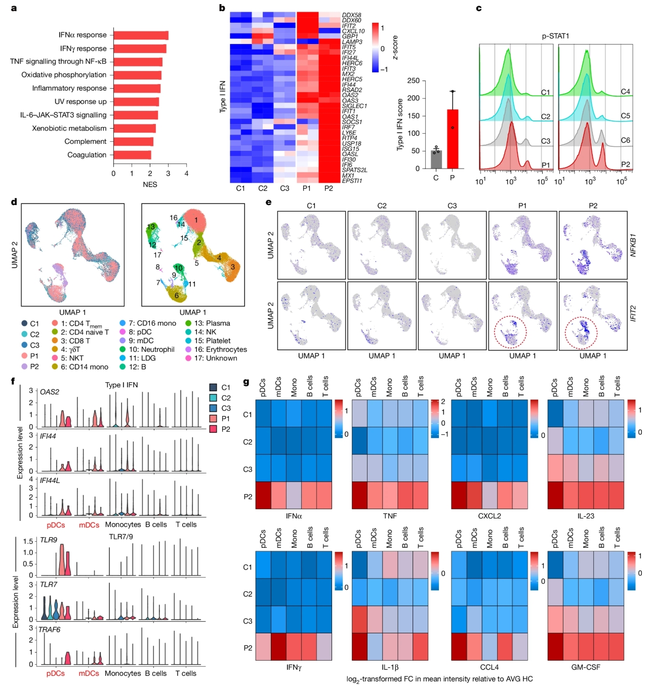 Nature | 颠覆认知！浙江大学/东部战区总医院研究团队合作锁定SLE新型致病基因：PLD4