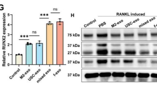 【IF 20.3】创新融合外泌体技术攻克假体周围骨溶解