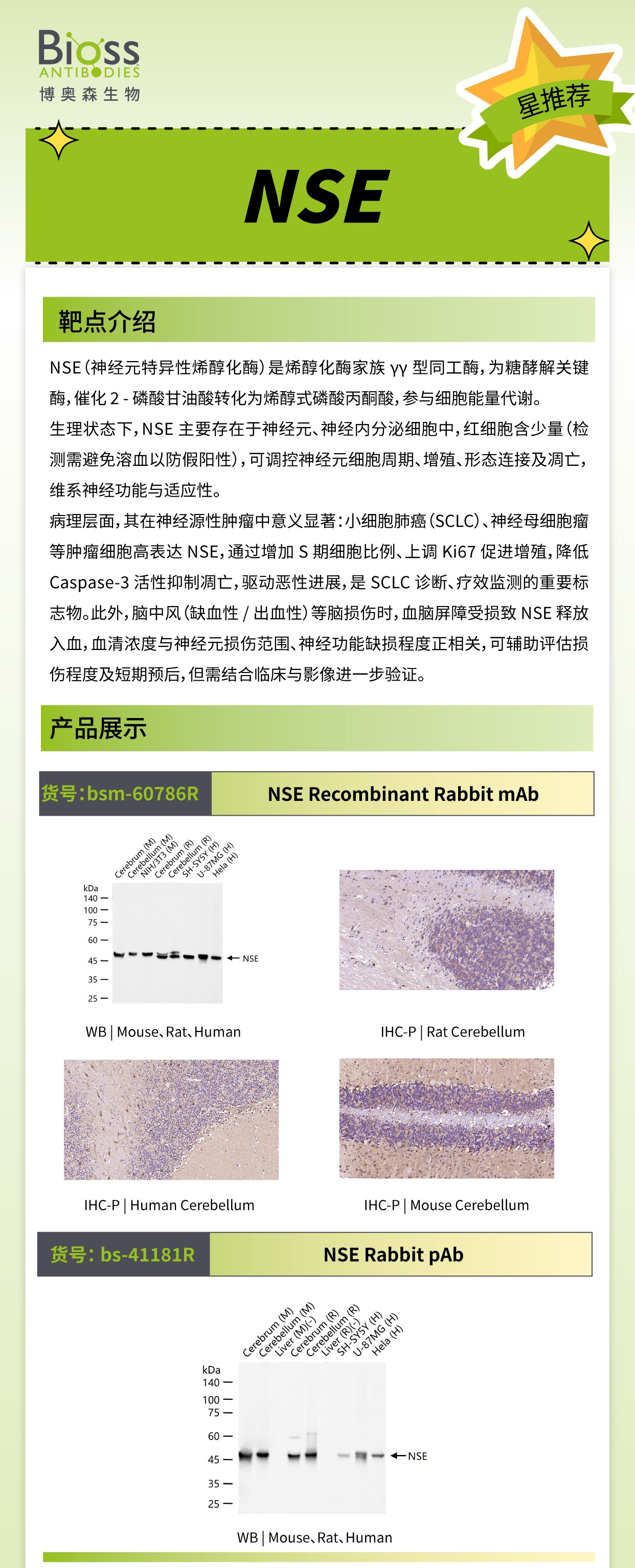 Bioss 星推荐 | NSE 抗体