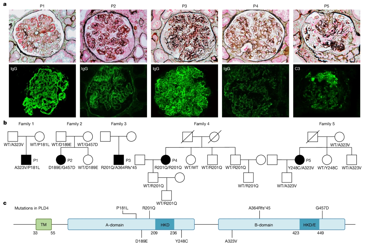 Nature | 颠覆认知！浙江大学/东部战区总医院研究团队合作锁定SLE新型致病基因：PLD4