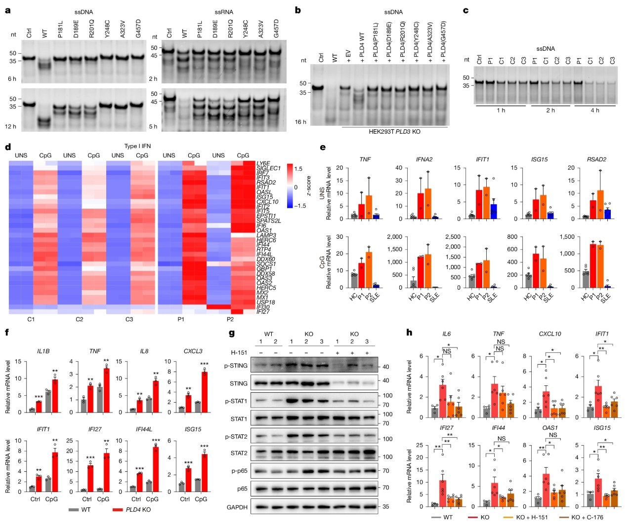 Nature | 颠覆认知！浙江大学/东部战区总医院研究团队合作锁定SLE新型致病基因：PLD4