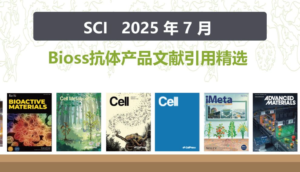 【2025年7月文献战报】Bioss 抗体新增高分文献精彩呈现