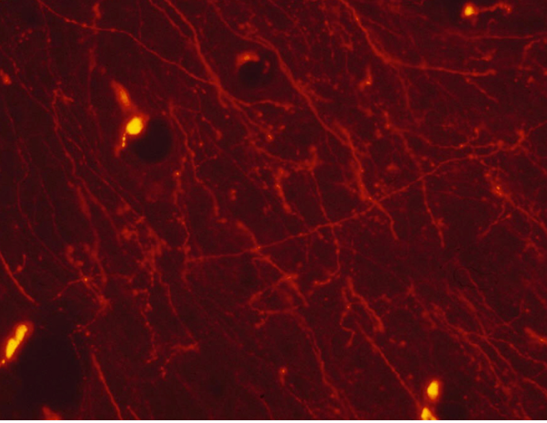 神经顺行示踪金标准-红色荧光金（Fluoro-Ruby）