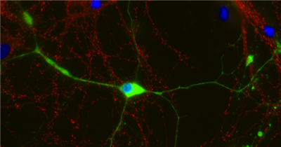 NanoTag-FluoTag-X2抗CNPase纳米抗体，现货专场，保障实验周期