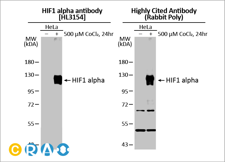 GeneTex HIF1α 抗体：推动缺氧研究