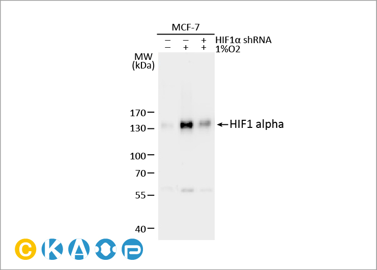 GeneTex HIF1α 抗体：推动缺氧研究