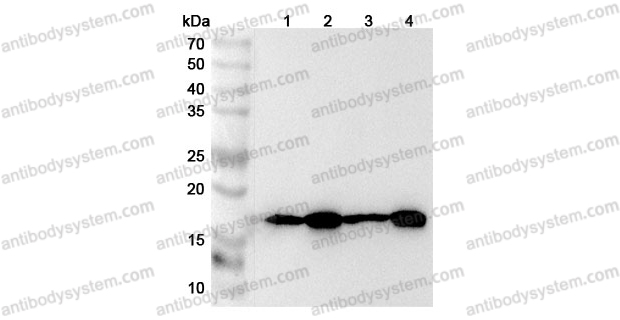 佰乐博生物蛋白抗体推荐Anti-Human TOMM20 Polyclonal Antibody