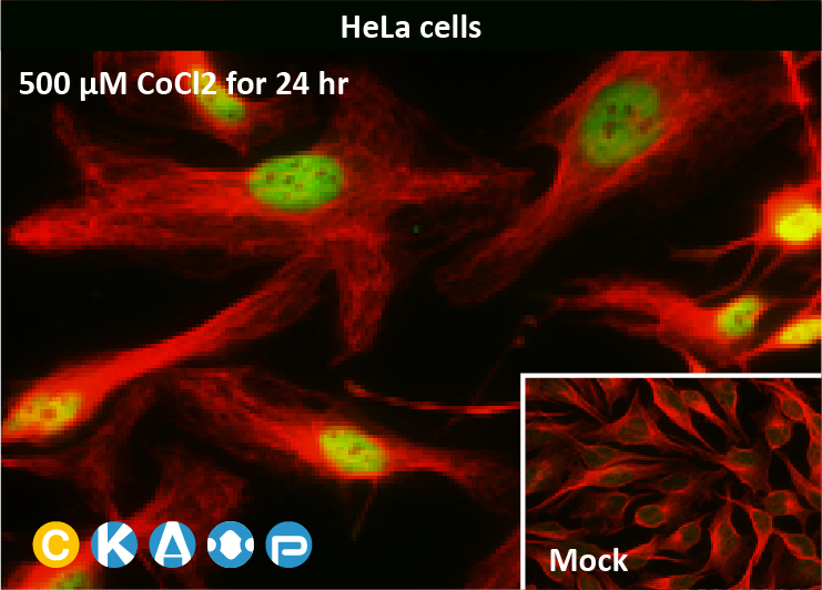 GeneTex HIF1α 抗体：推动缺氧研究