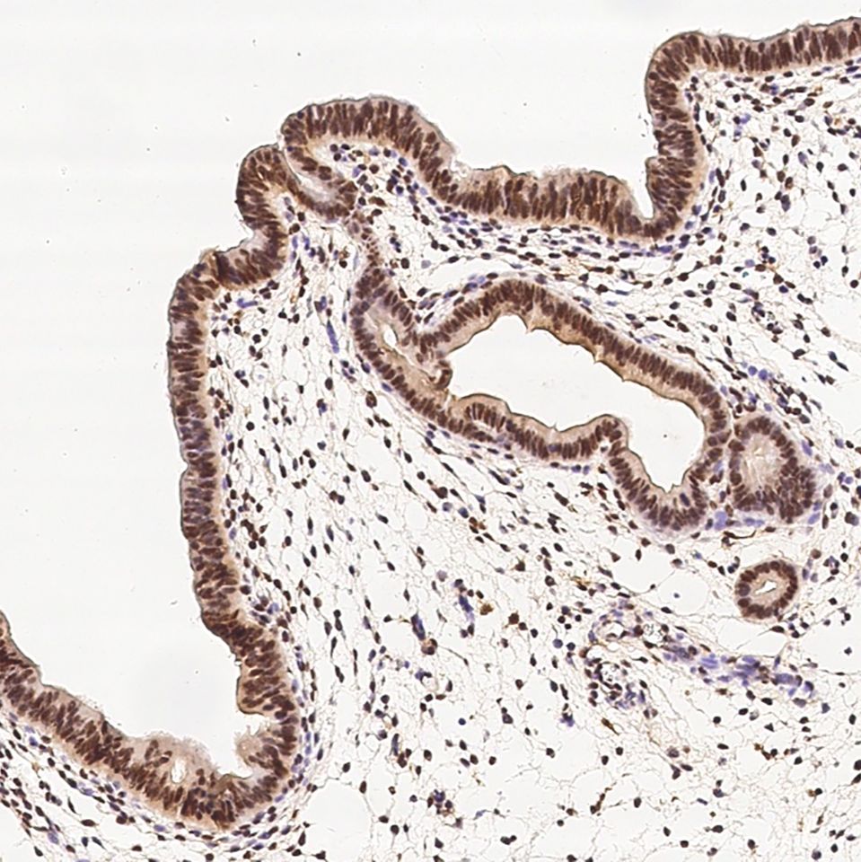 Sino Biological 人冠状病毒OC43核衣壳兔多抗 WB/ELISA 冠状病毒oc43