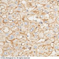 ACE2 兔多抗 | ACE2 Antibody, Rabbit PAb, Antigen Affinity Purified