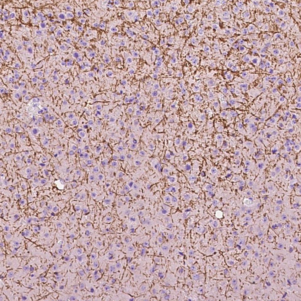 ER alpha/ESR1 兔多克隆抗体 (抗原亲和纯化)