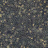 浙江(杭州)美森 人宫颈腺癌细胞HeLa (Luc2)现货