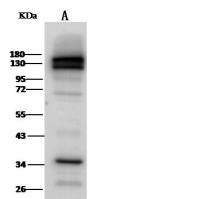 APOE / apolipoprotein E, Rabbit PAb | APOE / apolipoprotein E 兔多抗