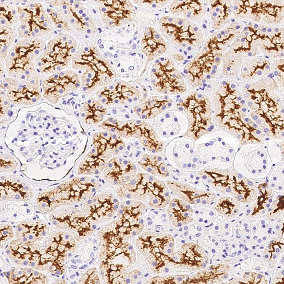 SARS-CoV-2 (2019-nCoV) Spike 兔多抗