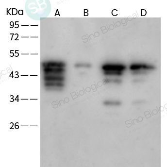 SARS-CoV-2 (2019-nCoV) Spike S2 兔单抗