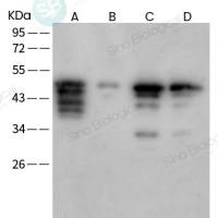 SARS-CoV-2 (2019-nCoV) Spike S2 兔单抗