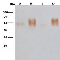 K-Ras 兔多抗 (抗原亲和纯化)