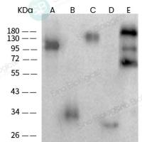 SARS-CoV-2 (2019-nCoV) Nucleocapsid 兔多抗