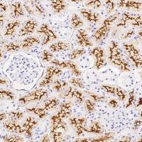 SARS-CoV / SARS-CoV-2 Nucleocapsid 兔多抗