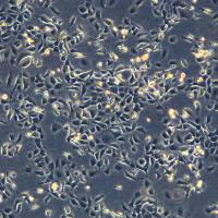 浙江（杭州）美森 人卵巢腺癌细胞OVCAR-5