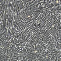 浙江（杭州）美森 人成纤维细胞 GM01176