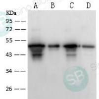 甲型流感H1N1 (A/Puerto Rico/8/1934) HA 兔多抗