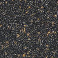 浙江（杭州）美森 小鼠肝星状细胞永生化