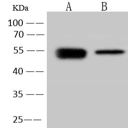 Influenza A H1N1 (A/California/07/2009) Hemagglutinin / HA 兔多抗