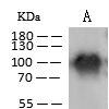 Coronavirus Nucleocapsid|Coronavirus Nucleocapsid antibody|Coronavirus Nucleocapsid抗体|Anti-MERS-CoV 兔多抗