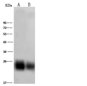 兔多抗 | Human coronavirus (HCoV-NL63) Nucleocapsid Antibody, Rabbit PAb, Antigen Affinity Purified