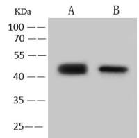 SerpinA3c Antibody, Rabbit PAb | SerpinA3c 兔多抗