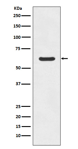 Asparagine Synthetase Rabbit m
