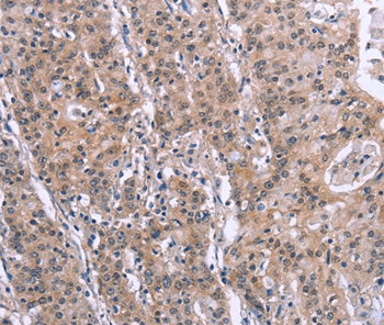 SLC52A1 Antibody[37605]