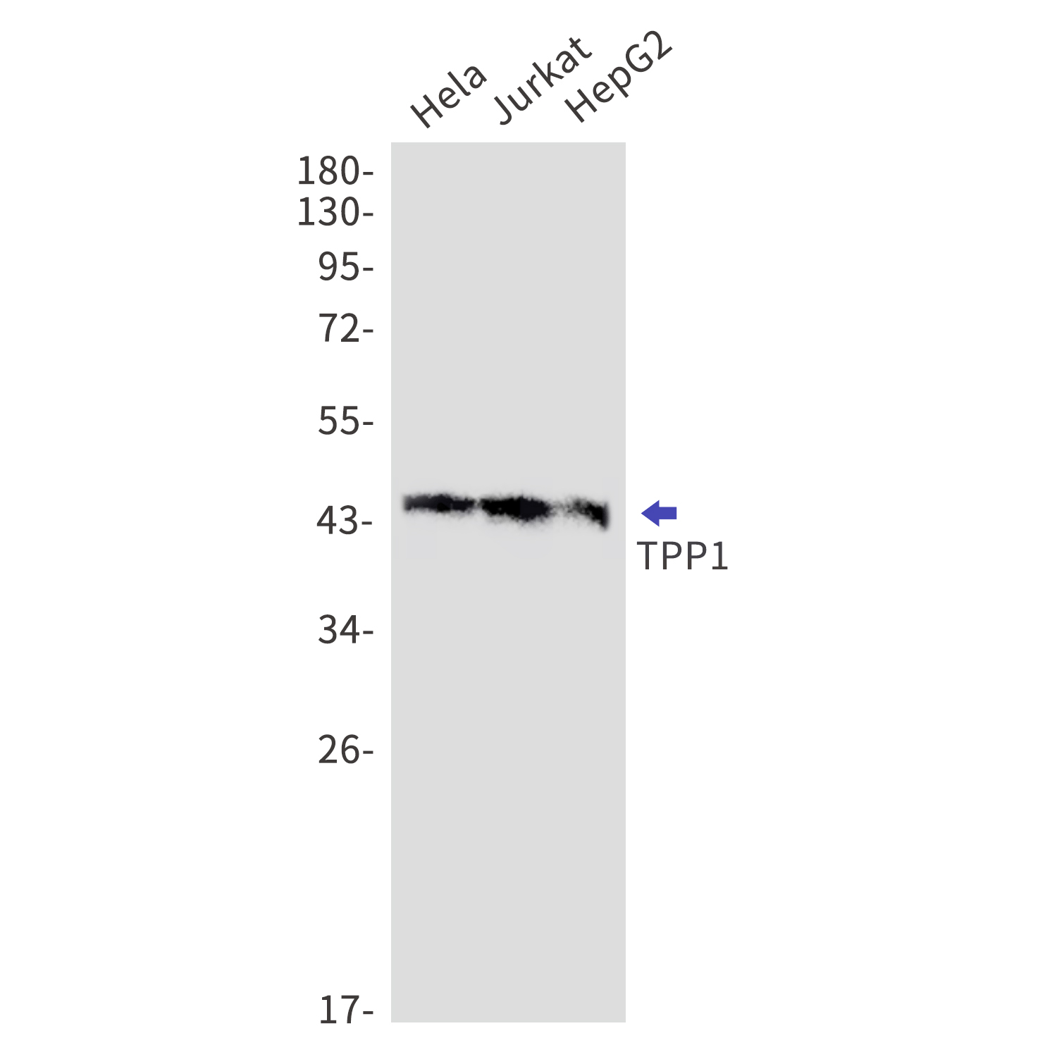 TPP1 Rabbit mAb[52626]