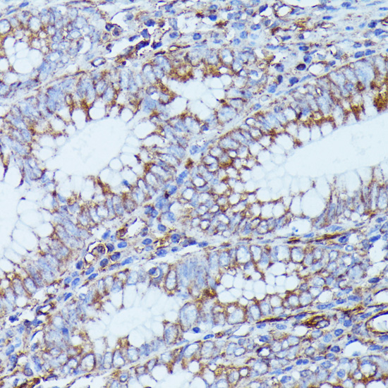 DDX6 Rabbit Polyclonal Antibod